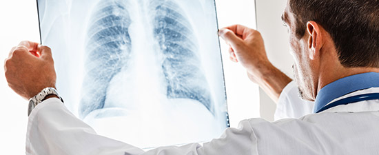 Sigarayi Birakma Nedenleri